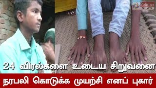 உத்தரப்பிரதேசத்தில் 24 விரல்களை உடைய சிறுவனை நரபலி கொடுக்க முயற்சி எனப் புகார்