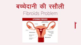 बच्चेदानी की रसौली - Fibroids Problem - Dr Neelu Koura