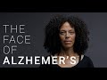 The Face of Alzheimer's - 2/3 Are Women