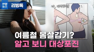 [리빙톡] '개도 안 걸린다는 여름감기?'…알고 보니 대상포진