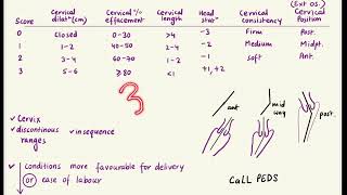 Bishop Score Mnemonic || AIIMS PG Previous Year