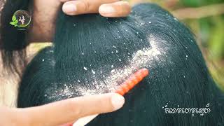 She scratch dandruff look so interested 2208