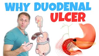 Understanding a Duodenal Ulcer