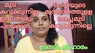 നരച്ച മുടി കറുക്കുന്നില്ലേ.എന്നാല് നിങ്ങൾക്കുള്ളതാണ് ഈ വീഡിയോ