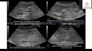 2020년 10월 6일 SMUSA Ultrasound zoom web symposium