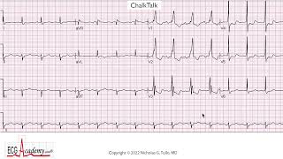 12-Lead ECG Challenge - Learn to Read EKG with Dr. Nick