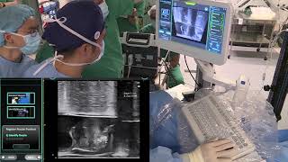 Core Videos (2020): Technique and Results of Prostate Waterjet Ablation by Aquablation®