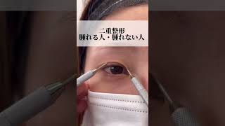 【二重整形】腫れる人と腫れない人の違いって？　#shorts