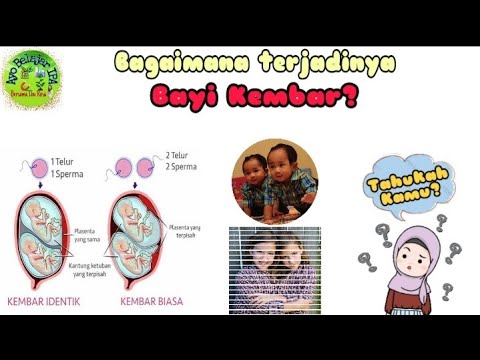 Tahukah Kamu Bagaimana Terjadinya Bayi Kembar? | Twin | Si Taka (SerI ...