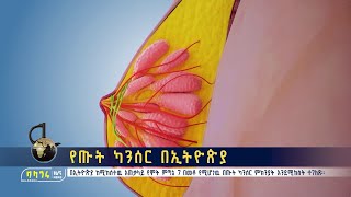 የጡት ካንሰር በኢትዮጵያ