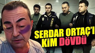 Serdar Ortaç'a Yapılan Saldırının Şok Eden Gerçeği!