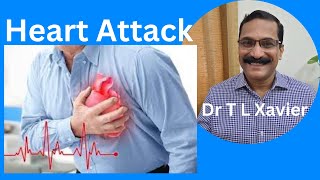 Unlock the Secret to a Healthy Heart — Myocardial Infarction!