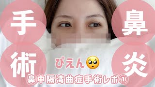 【鼻中隔湾曲症】鼻炎でお悩みの方絶対見てください👃手術レポ①