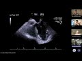 Critical care echo cases