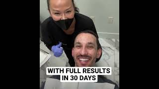 Botox for Men - Male Botox Results - Before and After Botox on Men