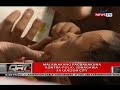 qrt malawakang pagbabakuna kontra polio isinagawa sa qc