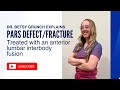 Case study 76- Dr. Grunch EXPLAINS Pars defect/fracture treated by anterior lumbar interbody fusion