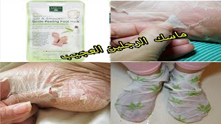 Foot Peel Mask/طريقة استخدام ماسك  القدمين👣 الكوري لي عامل ضجة والنتيجة😱 كانت صدمة