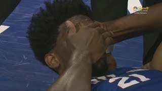 Joel Embiid Barely Able To Walk After Suffering Concussion From Hitting Heads With Markelle Fultz!