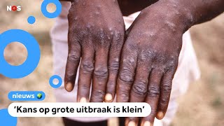 Apenpokkenvirus nu ook in Nederland
