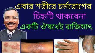 চর্ম রোগের ভালো এবং নিরাপদ হোমিও ঔষধ || best homeopathic medicine for skin disease || Dr SP Goswami