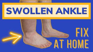 Swollen Painful Ankles, Fix them At Home!