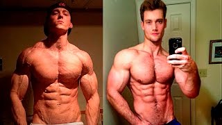 Connor Murphy vs Zach Zeiler - Aesthetics Motivation