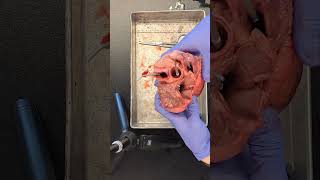 Pluck dissection--internal anatomy