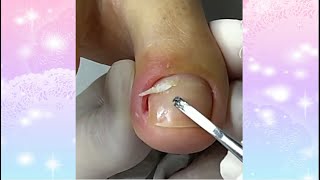 toenail cleaning satisfying Nasa Beauty