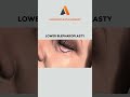 Lower Blepharoplasty | Answer Plastic Surgery #shorts #protrusioncorrection