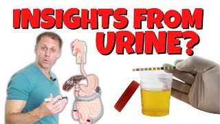 What Can You Learn From Your Urine