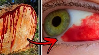 Top 10 Most Dangerous Trees in the World