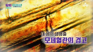 ※통하면 살고 막히면 죽는다!※ 무시하다가는 목숨이 위험한 모세혈관의 경고 | TV 주치의 닥터 지.바.고 292 회