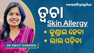 ଚର୍ମ ଜନିତ ଆଲର୍ଜି: କେମିତି ଭଲ ହେବ? | Skin Allergy: Symptoms \u0026 Treatment in Odia | Dr Swati Sarangi