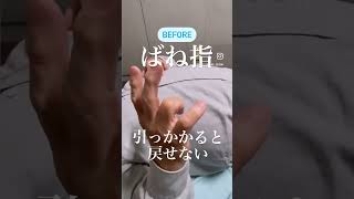 ｢たった1回で良くなるばね指｣#群馬整体#桐生整体#桐生市#ばね指