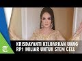 Krisdayanti Pernah Lakukan Stem Cell Seharga Rp1 Miliar