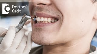 What causes bleeding gums and how to manage it? - Dr. Aniruddha KB