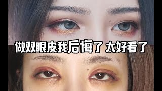 瞒着父母去做双眼皮修复手术Vlog  by青云红衅