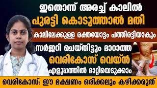 സർജറി ചെയ്തിട്ടും മാറാത്ത വെരികോസ് വെയ്ൻ മാറാൻ ഇതൊന്ന് അരച്ച കാലിൽ പുരട്ടികൊടുത്താൽ മതി