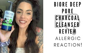 Biore deep pore charcoal cleanser review ALLERGIC REACTION