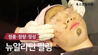 여드름 얼굴 고민해결 뉴알라딘필링 시술 영상 톡스앤필