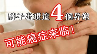 体内有癌，脖子先知，如果脖子出现这4个异常，或是癌症来了