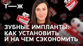 Зубные импланты: сколько стоит установка, как сэкономить