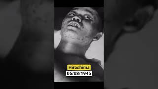 Horror Hiroshima Bombing & Victims 🙏 #shorts