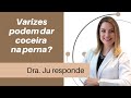 Varizes podem causar coceira nas pernas?