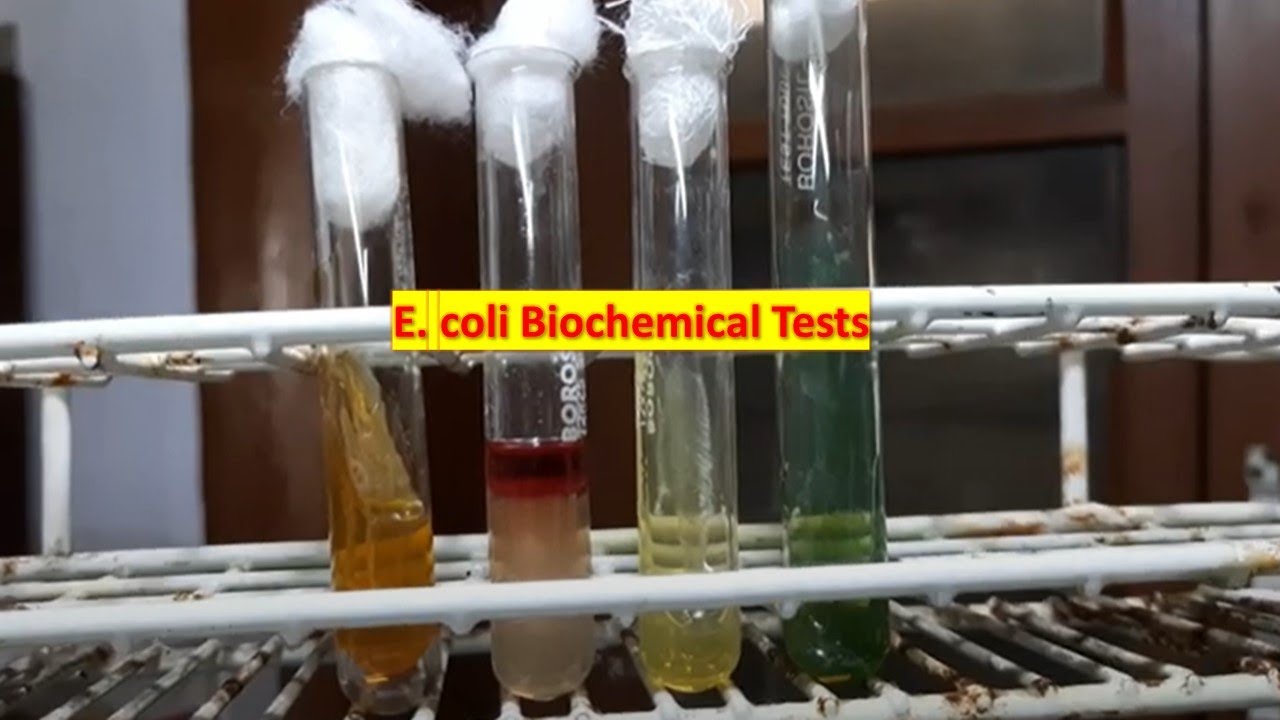 E. Coli Biochemical Tests Demonstration - YouTube