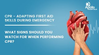 Apollo Hospitals | What signs should you watch for when performing CPR? | Dr. Imron Subhan