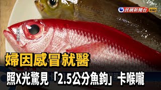 婦因感冒就醫　照X光驚見「2.5公分魚鉤」卡喉嚨－民視新聞