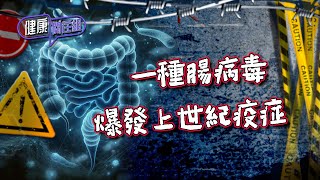 健康關注組｜ EP200 PT1｜ 一種腸病毒 爆發上世紀疫症 ｜ 腸病毒 ｜ 小兒麻痹症 ｜ 敖嘉年 ｜ 麥詩敏 ｜ HOY TV 77台