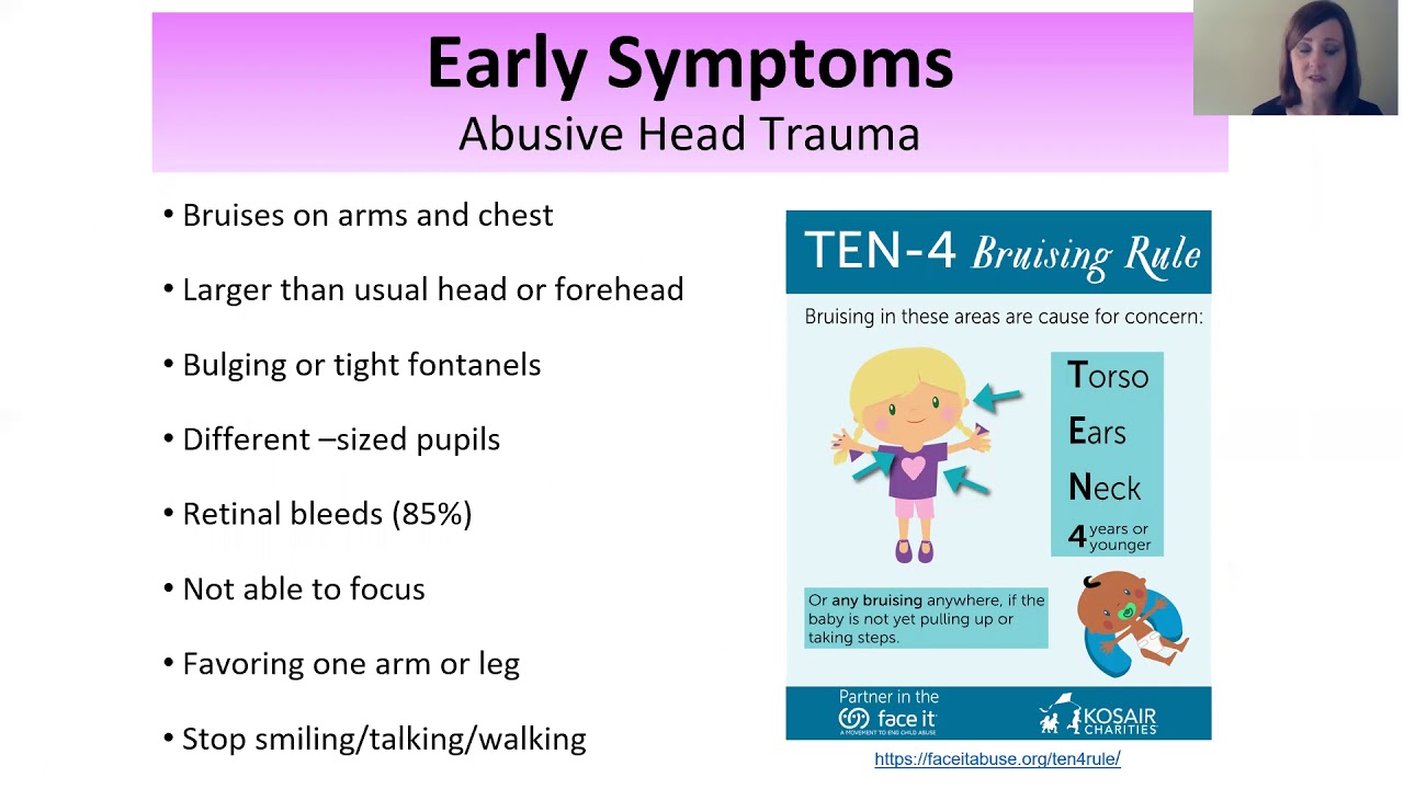 Signs Of Head Trauma In Baby - Templaterilly